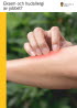 Omslagsbild som visar en arm med exem och en hand som kliar det besvärande området.